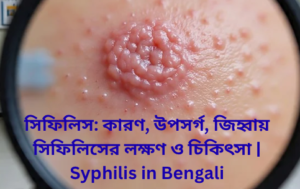 সিফিলিস: কারণ, উপসর্গ, জিহ্বায় সিফিলিসের লক্ষণ ও চিকিৎসা | Syphilis in bengali